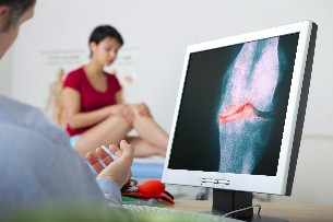 osteoartritas diagnostika