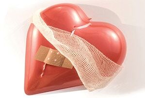 Krūtinės ląstos stuburo osteochondrozė neigiamai veikia širdį